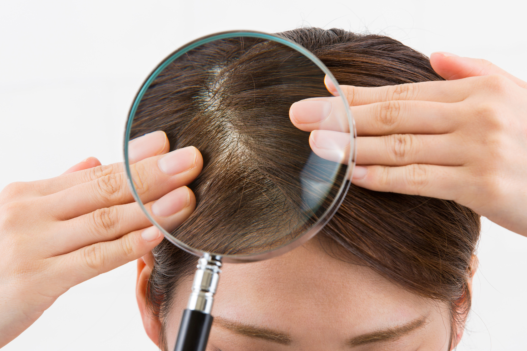 女性で地肌が見える位の薄毛は髪が細いのが原因 育毛の処方箋
